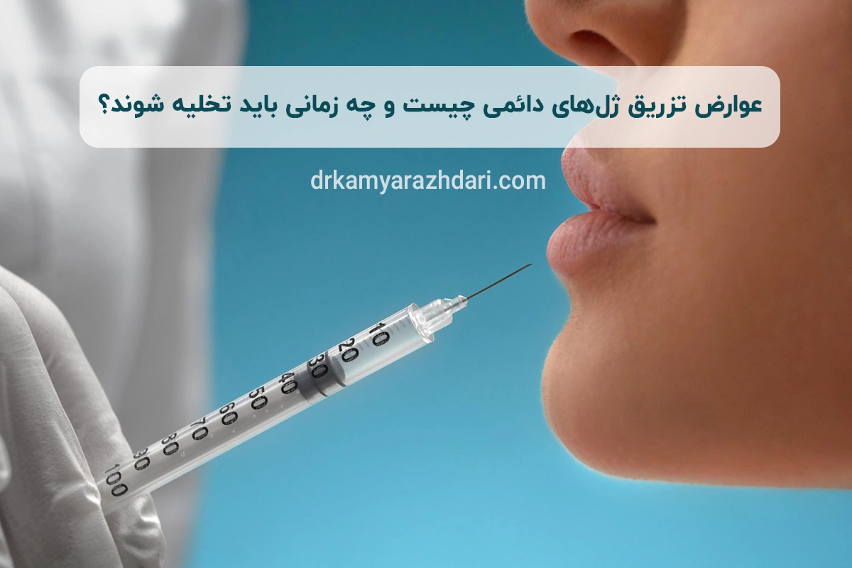 عوارض تزریق ژل‌های دائمی چیست و چه زمانی باید تخلیه شوند؟
