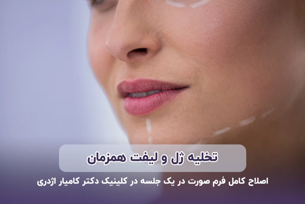 تخلیه ژل و لیفت همزمان
