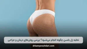 تخلیه ژل باسن چگونه انجام می‌شود؟